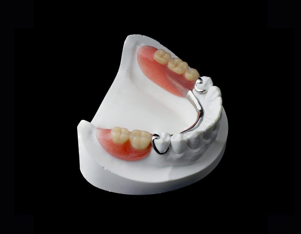 Partial dentures at Jasper Denture Clinic